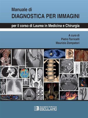 cover image of Manuale di Diagnostica per Immagini. Per i corsi di laurea in Medicina e Chirurgia